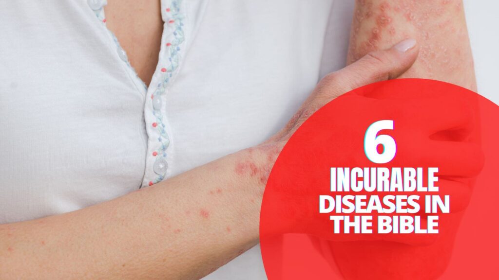 6 Incurable Diseases In The Bible Bible Verses   INCURABLE DISEASES IN THE BIBLE 1 2 1024x576 